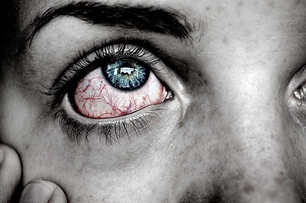 ojos inyectados en sangre síntoma de diabetes ojos inyectados en sangre síntoma de diabetes